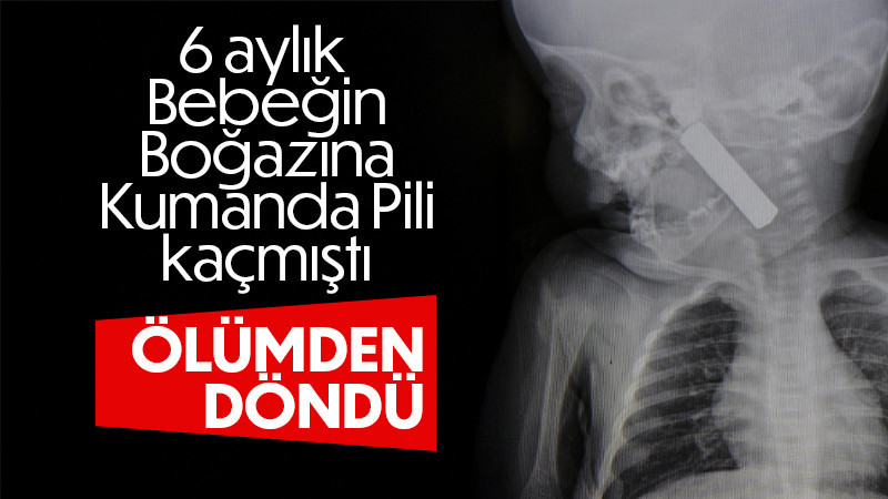 Karaman'da boğazına kumanda pili kaçan bebek ölümden döndü